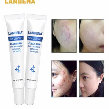 Lanbena Acne Treatment Gel