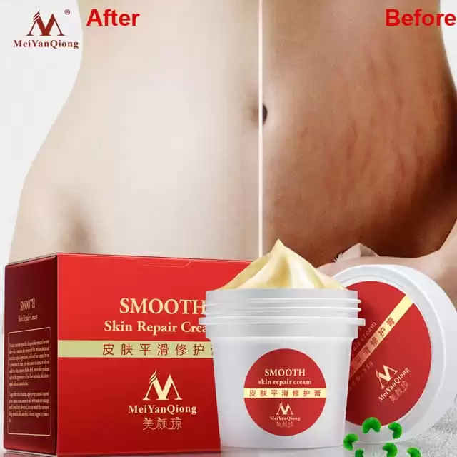 Meiyanqiong Smooth Skin Repair Cream High Quality Smooth Skin Cream For Stretch Marks Scar Removal To Maternity Skin Repair Body Cream 1.Jpg 640X640 1