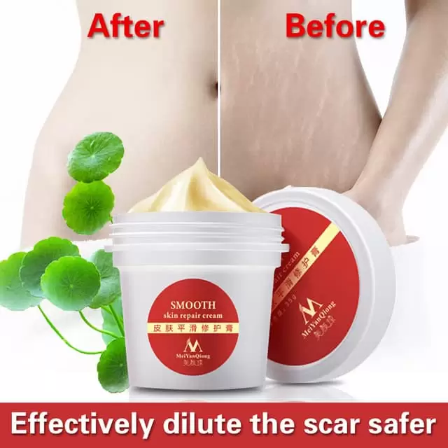 Meiyanqiong Smooth Skin Repair Cream High Quality Smooth Skin Cream For Stretch Marks Scar Removal To Maternity Skin Repair Cream Remove 1.Jpg 640X640 1