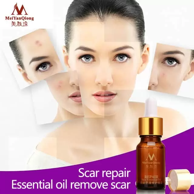 Meiyanqiong Repair Skin Essential Oil Meiyanqiong Scar Repair Essential Oil Lavender Essence Skin Care Natural Pure Remove Burn Stretch Marks