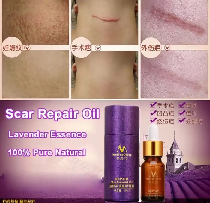 Meiyanqiong Repair Skin Essential Oil Bioaqua Serum Wajah Acne Scar Tratment 10G Brown 4