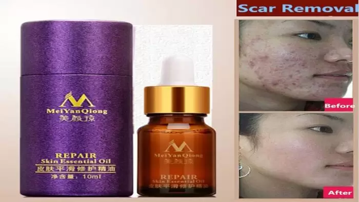 Meiyanqiong Repair Skin Essential Oil