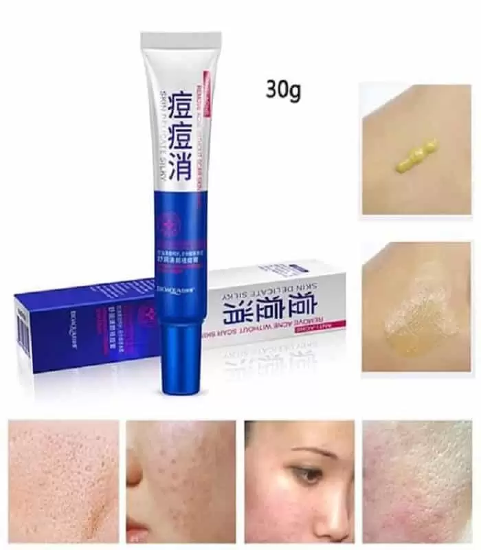 Bioaqua Anti Acne Skin Delicate Silky