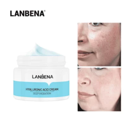 lanbena acid cream
