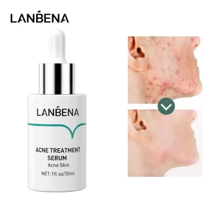 Lanbena acne serum review