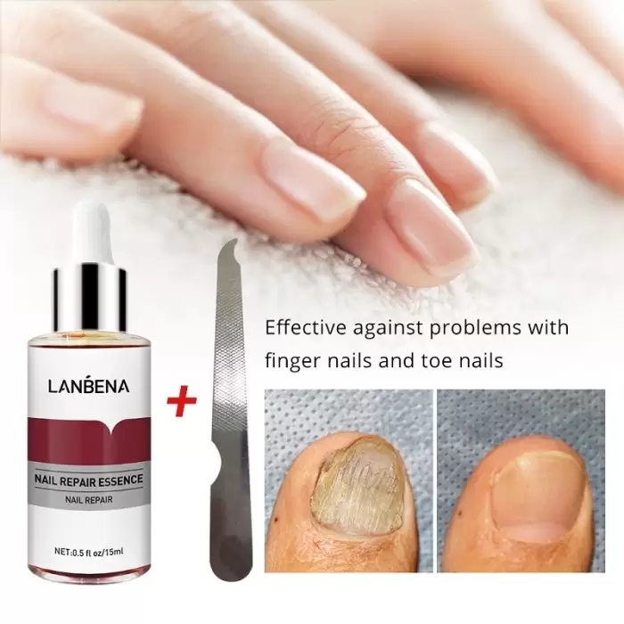 Lanbena Nail Repair Essence (Anti-Fungal) - 15M