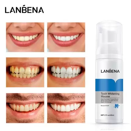 LANBENA Teeth Whitening Mousse